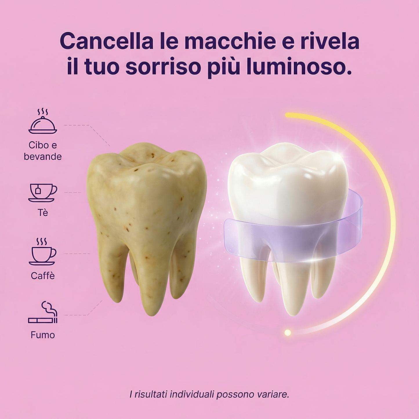 GlowSmile Strisce Sbiancanti